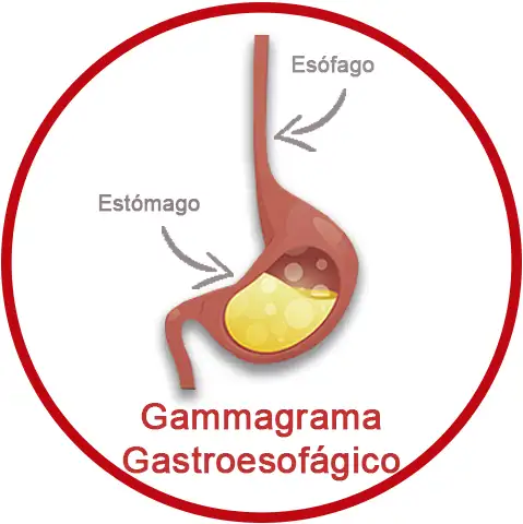 Gammagrama Gastroesofágico