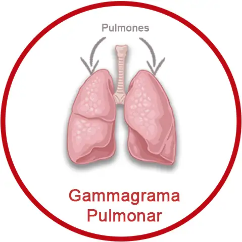 Gammagrama Pulmonar Perfusorio Y Ventilatorio