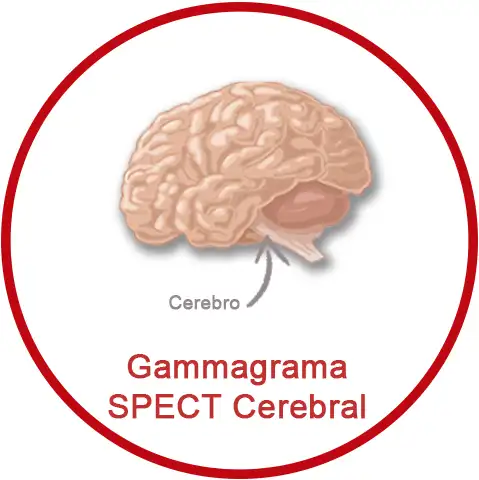 Gammagrama SPECT cerebral