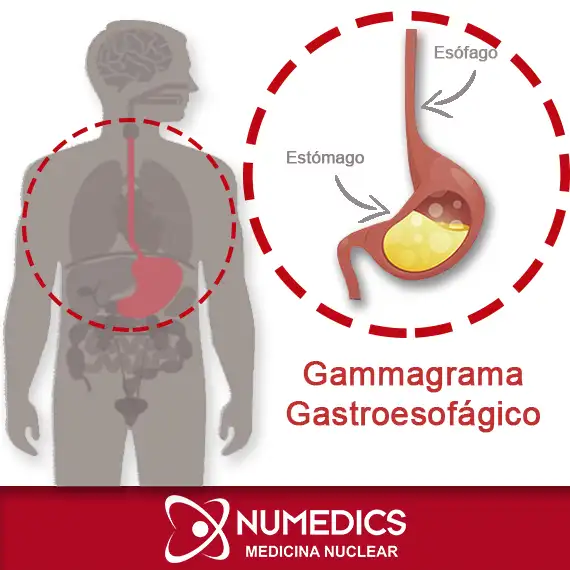 Gammagrama Gastroesofágico