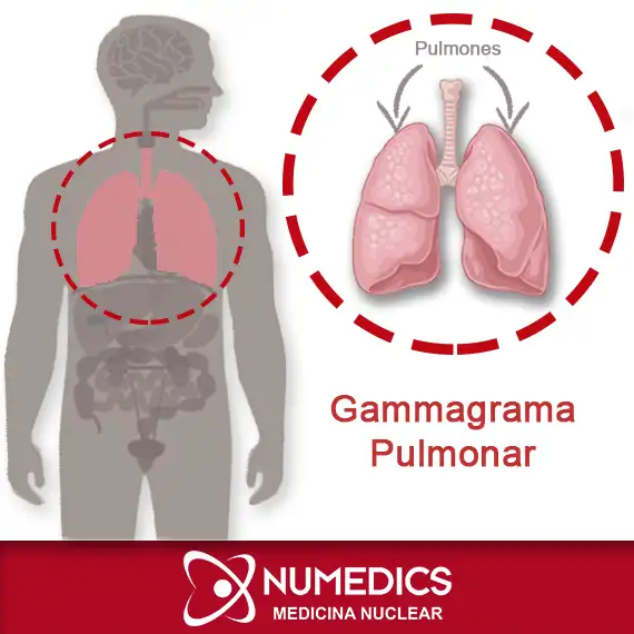 Gammagrama Pulmonar