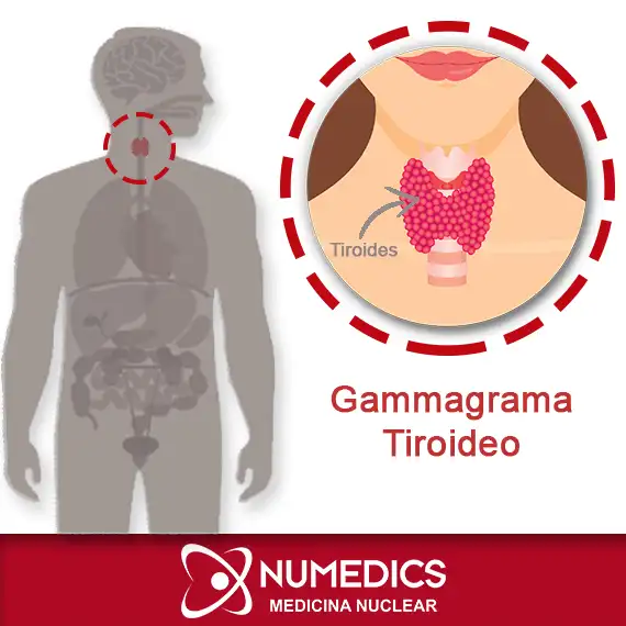 Gammagrafía Tiroidea